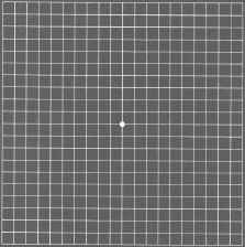 Amsler Grid